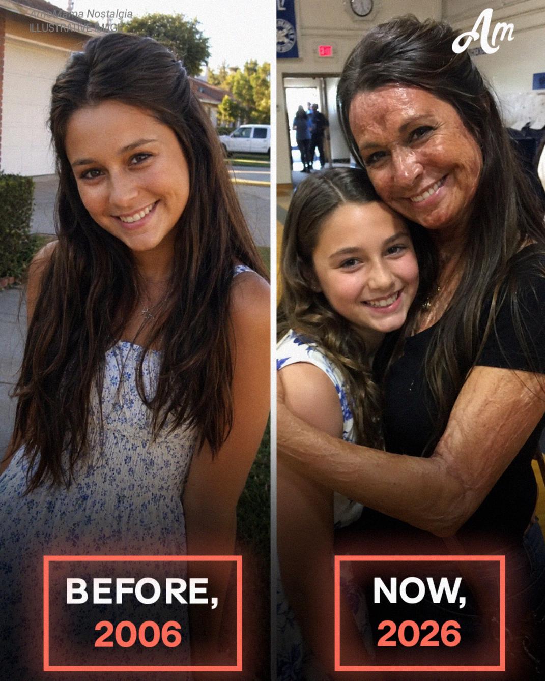 MY DAUGHTER WAS MOCKED FOR MY SCARRED FACE — UNTIL A STRANGER WALKED INTO HER SCHOOL AND SAID, “IT’S TIME EVERYONE LEARNED WHAT THIS WOMAN HAS BEEN HIDING FOR 20 YEARS.”  “Mommy,” my 11-year-old daughter, Clara, whispered, “CAN YOU PLEASE STOP COMING TO MY SCHOOL?”  My heart cracked.  Clara’s classmates were preparing for a Mother’s Day event. Every child was allowed to bring their mom onstage and explain why she was special.  But when it was my daughter’s turn, the other children BURST OUT LAUGHING.  All because of the scars across my cheek, jaw, and neck.  They called me a MONSTER.  Then they called Clara “THE MONSTER’S BABY.”  “I love you so much, Mom,” Clara cried, “but I can’t stand them laughing at me.”  Before I could stop myself, I touched the scars running down my cheek and neck.  I got them when I was sixteen.  A fire broke out in our apartment building. While everyone else ran outside, I heard CHILDREN SCREAMING from the second floor.  I saved three kids that night.  But the flames took the face I used to have.  I never told anyone how I got those scars.  For years, I told myself it didn’t matter. But seeing my daughter ashamed because of me hurt worse than the fire ever had.  I knelt in front of her and held her hands.  “Then I’ll come,” I said, “so you never have to be embarrassed by the truth.”  The next morning, I put on my best dress, styled my hair, and did my makeup.  When I walked into the auditorium, the room changed.  Whispers. Stares. A boy covered his mouth and laughed.  Clara’s face went pale.  I stepped onto the stage and spoke into the microphone.  “I’m Clara’s mother. And these scars are not the worst thing that ever happened to me.”  But before I could say another word, the auditorium doors flew open.  A young man walked in.  “You laughed at this woman,” he said, his voice loud enough for everyone in the room to hear. “But you should know SHE HAS BEEN LYING ABOUT THAT FIRE for twenty years.”  I recognized his voice.  But nothing could have prepared me for WHAT HE SAID NEXT.  The story continues in the comments. ⬇️ Voir moins