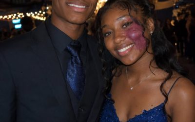 Only one boy asked me to prom since no one else wanted to go with me because of the birthmark on my face — everyone laughed until police officers walked into the gym.