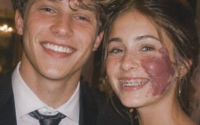 Off The Record Only One Boy Asked Me To Prom Because Of My Birthmark—Until An Officer Walked In