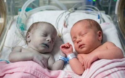 The Nurse Placed a Lifeless Newborn Beside Her Healthy Twin for a Final Goodbye—Then Something Incredible Happened1